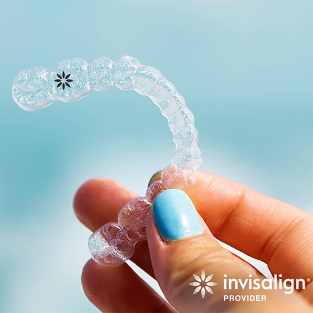 Invisalign Aligners Image